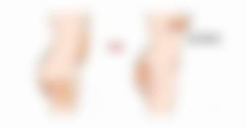 打过瘦脸针后1周内的注意事项