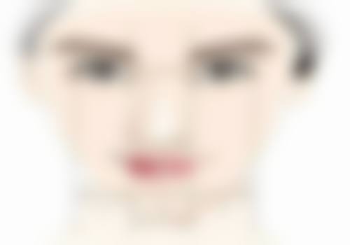 眼部整形手术，如眼部整形等。