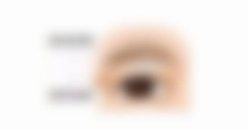 打除皱针后怎么保养？短期防水防按、日常饮食作息注意，长期护肤复查别忘