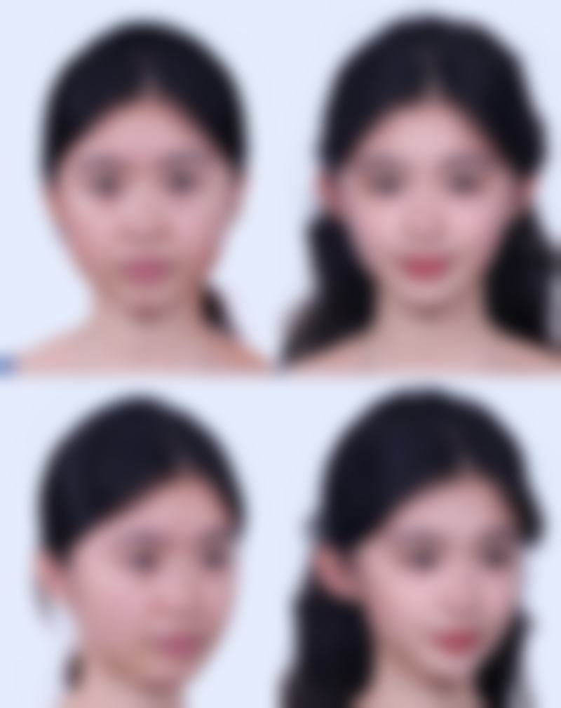 保定蓝途整形医院口碑如何？