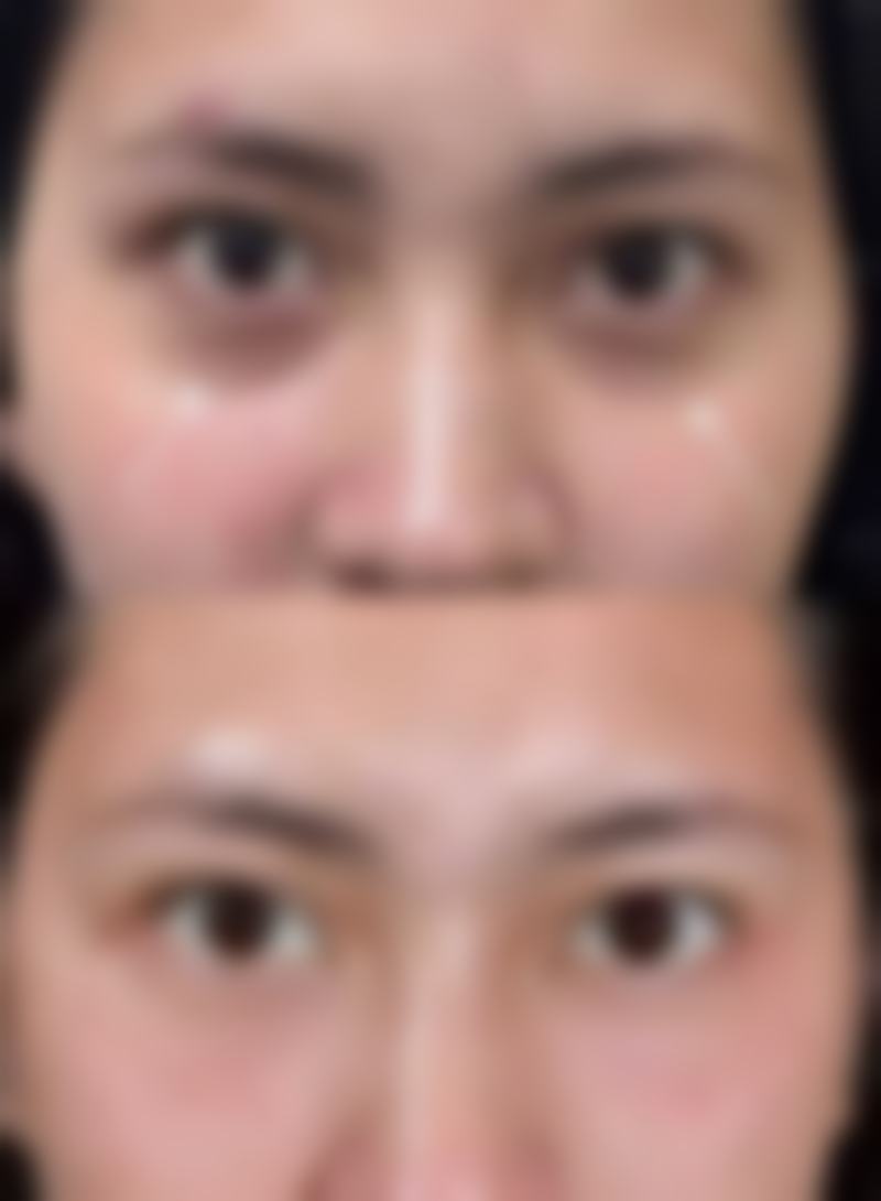 福州华窈医疗美容医院电话号码及预约方法