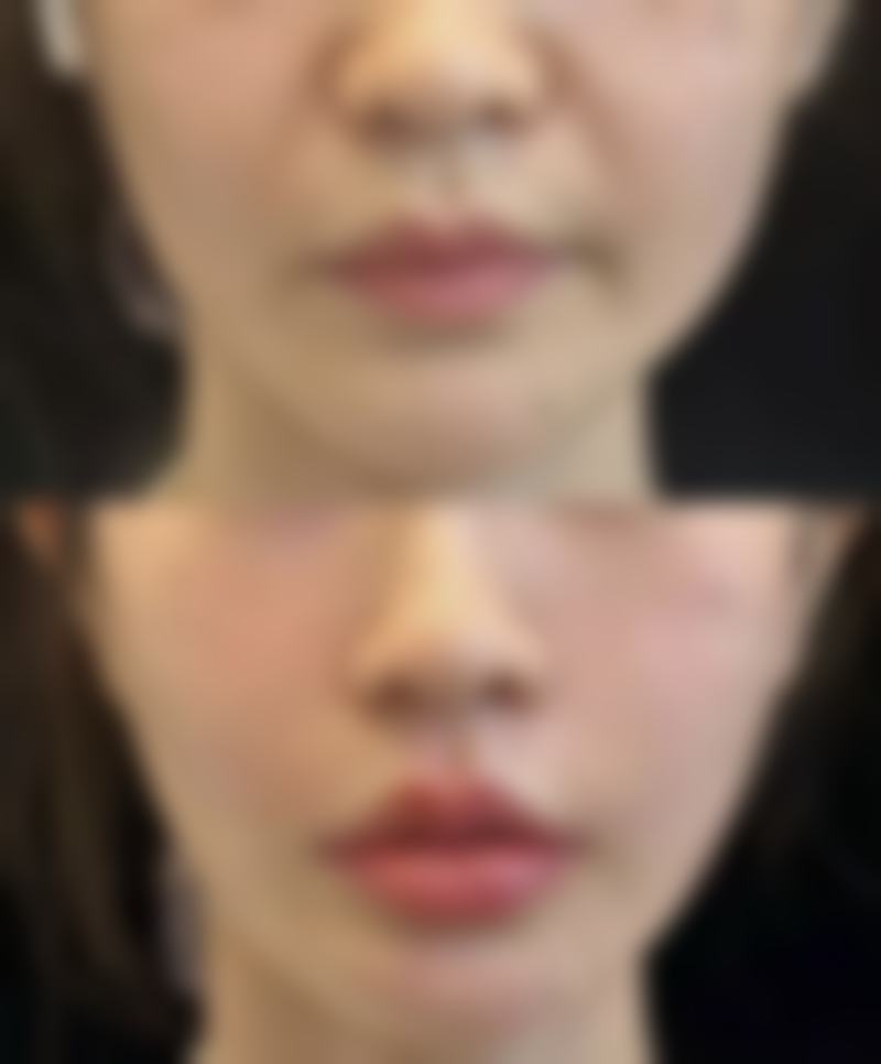 眼部整形手术，如眼部整形、鼻部整形等。