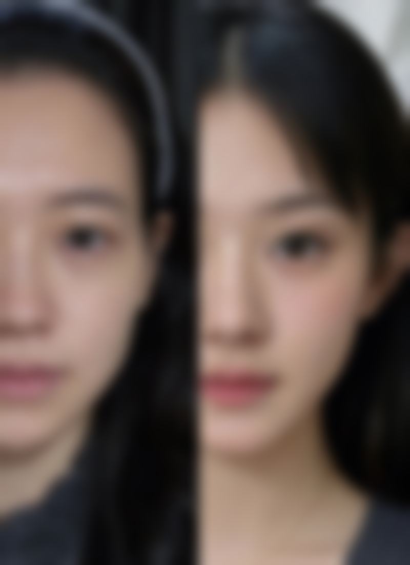 打过瘦脸针要注意什么？24小时、1周内外护理及选正规医院医生都重要