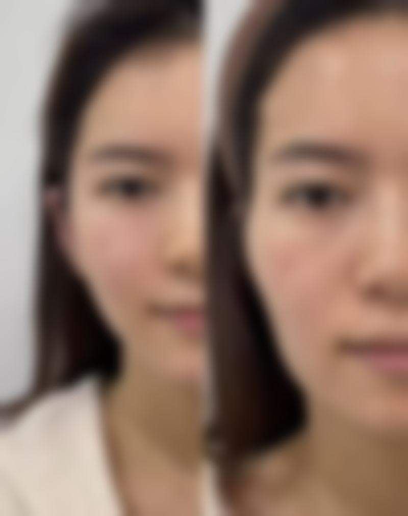 不同人群适合的美白针牌子