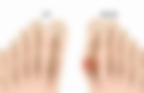 打了除皱针可以维持多久？不同类型时间不同，还受代谢、护理等因素影响