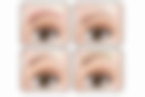 什么情况下肋骨隆鼻需要假体