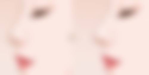 总结——苏州张小熊医疗美容诊所怎么样？