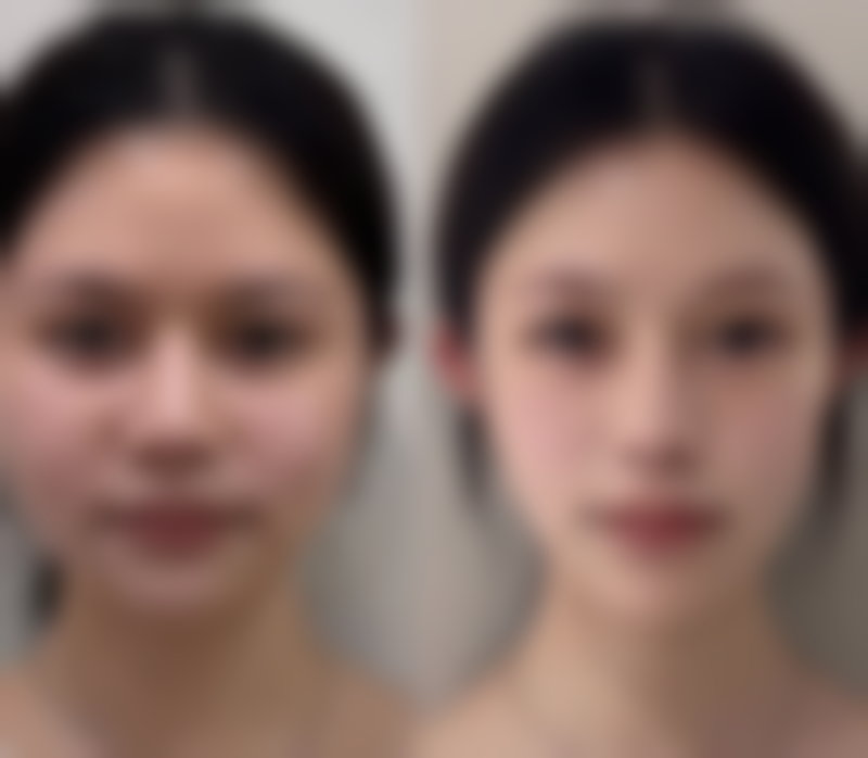 韩国365mc医院金星旼(大田院)医生挂号预约攻略