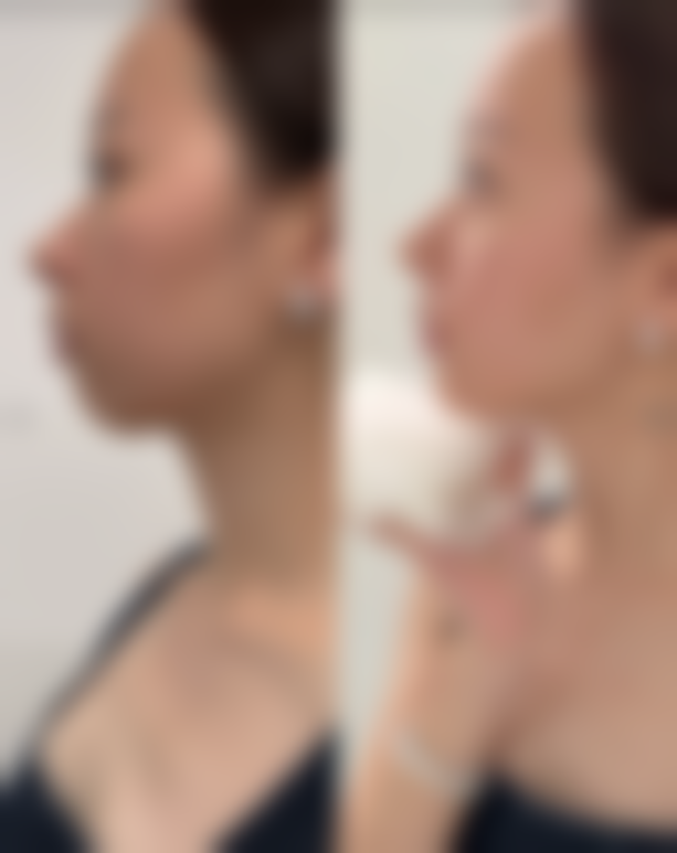 贞韩植发医院技术好不好？