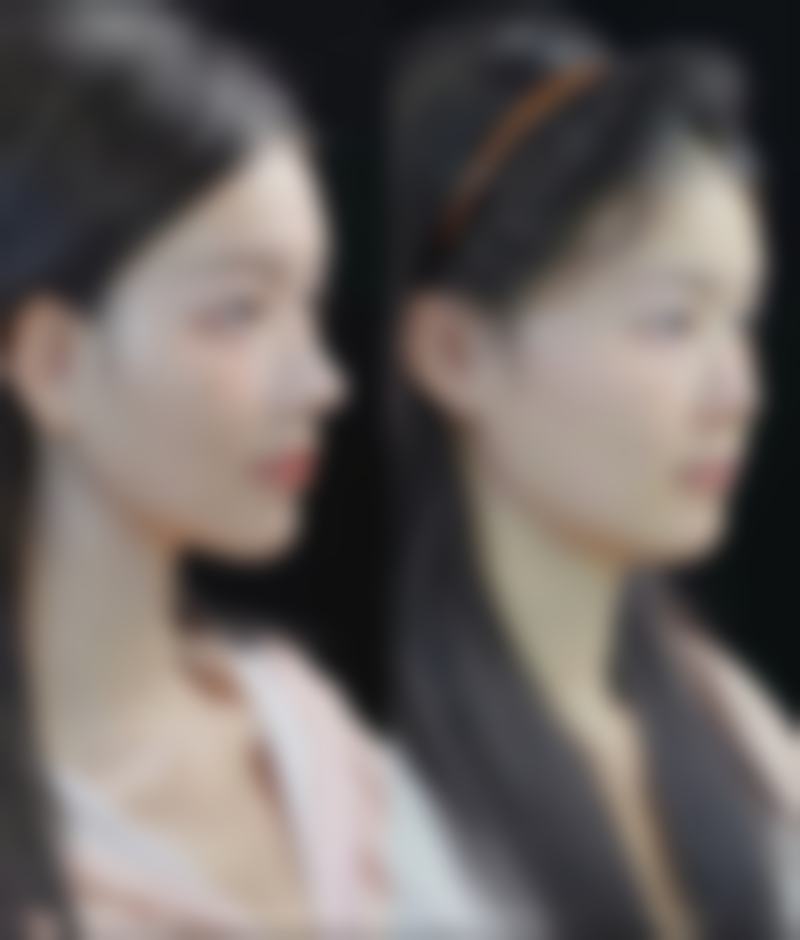 下颚和下颌在整形手术中的应用