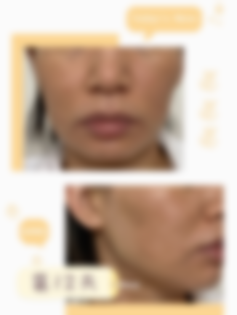 体验广东韩妃医疗美容医院的半岛超声炮项目,个人感受怎样?