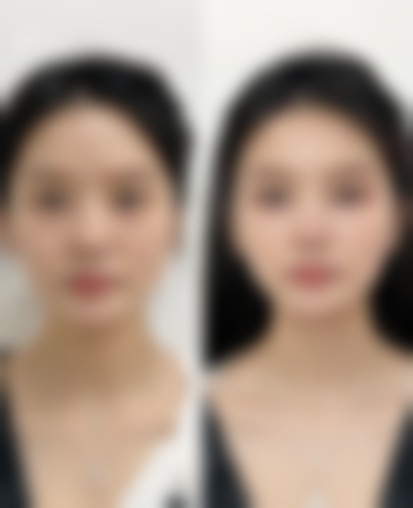 下颚和下颌在临床中的表现