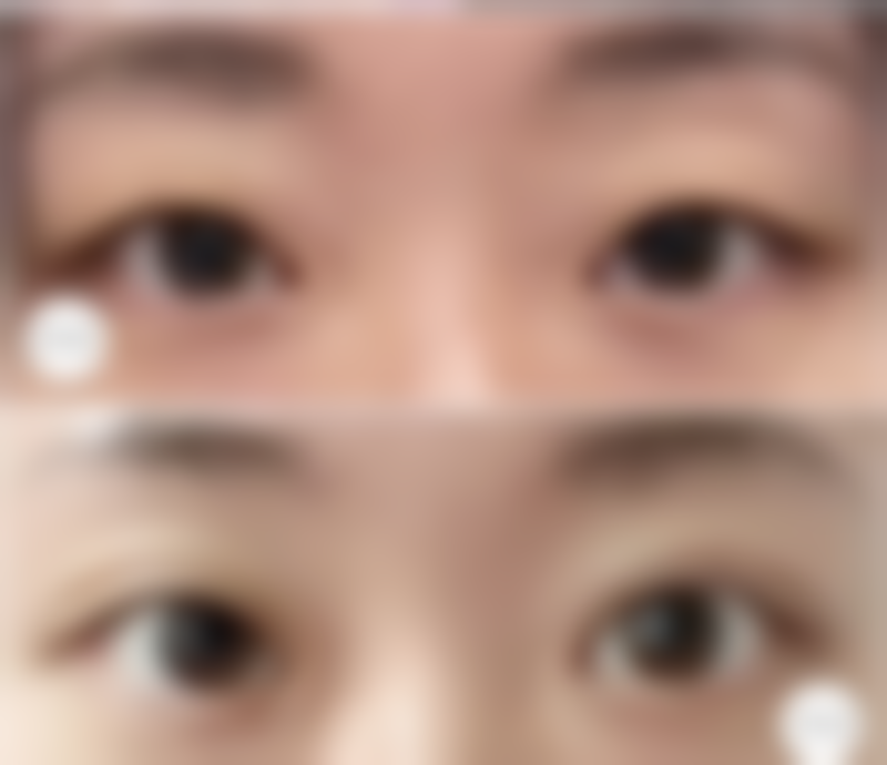 总结——韩国365mc医院李宋律（首尔院）医生怎么样？