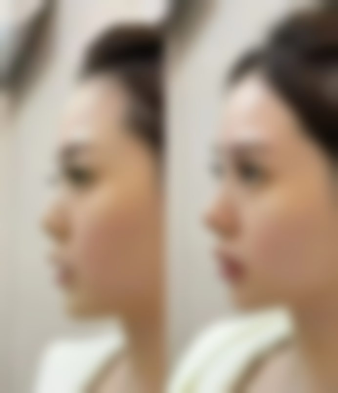 总结——北京惜娜整形医院怎么样？