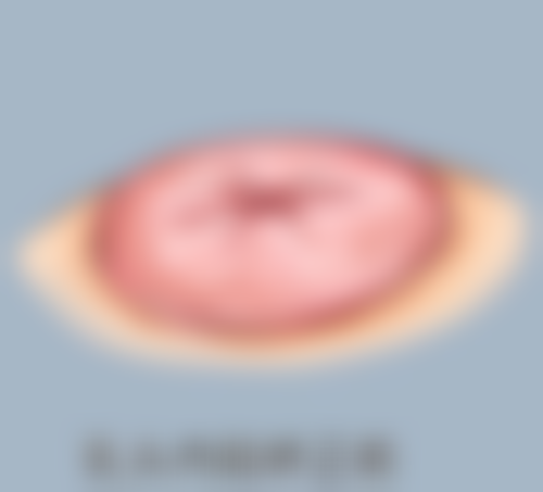 抽脂手术的危害有哪些？皮肤问题、脏器损伤、心理落差及生活不便等了解一下