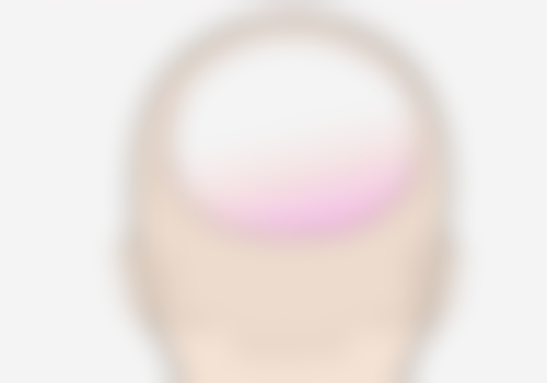 小阴唇缩小手术有危险吗？风险、恢复时间、价格及医院选择全揭秘