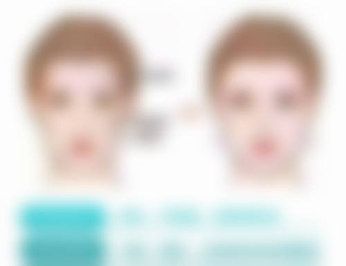 美容院打除皱针的价格陷阱