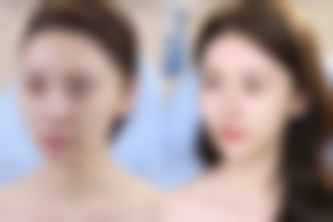 武汉新生医疗美容门诊部口碑如何？