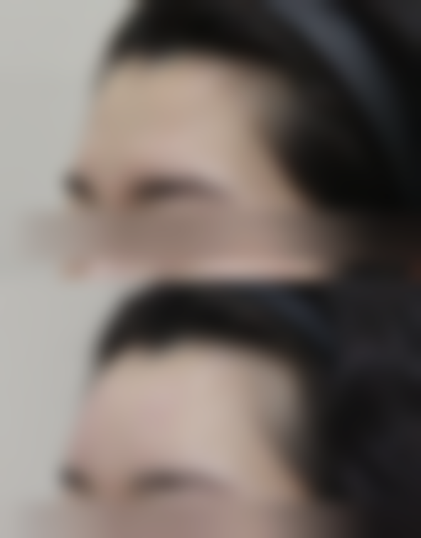 总结——商丘华美整形医院怎么样？