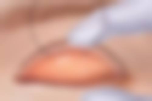 总结——天津韩铭医疗整形门诊部怎么样?