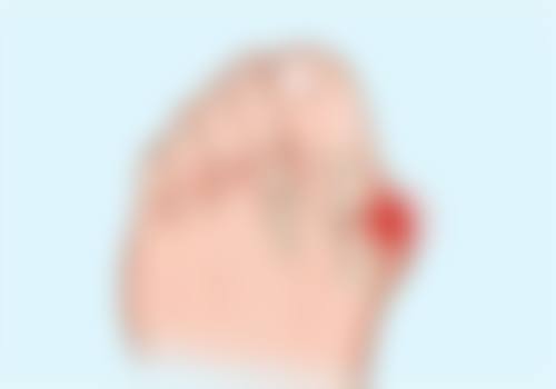 蛋白线隆鼻怎么样？原理、维持时间、风险价格及适用人群全揭秘