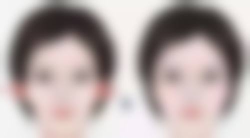 特殊唇部修复整形价格大概多少