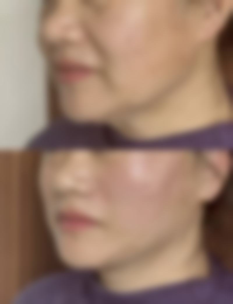 丰太阳穴可缓解心理压力