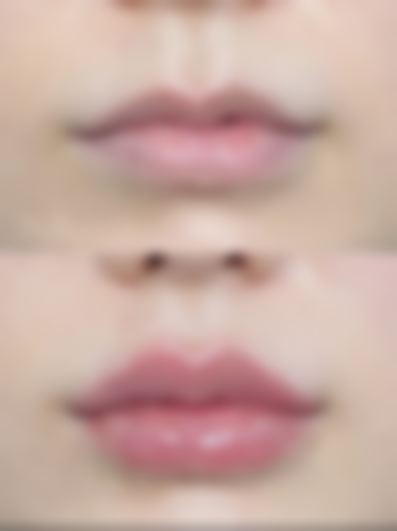 成都艺美医疗美容诊所口碑如何?