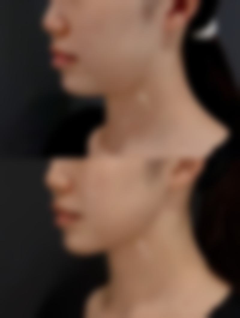 大连星妍医疗美容收费标准参考