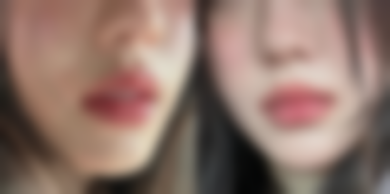 瑞士revival瑞诺美白针