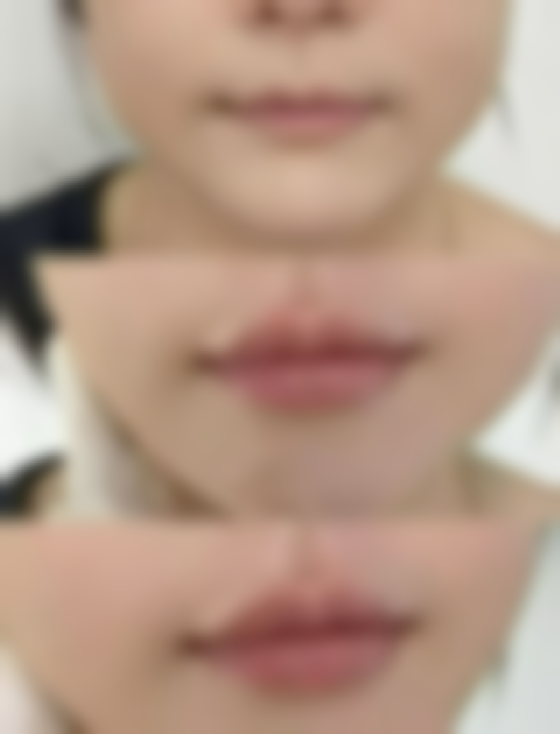 南宁柠檬爱美医疗美容门诊部医生简介