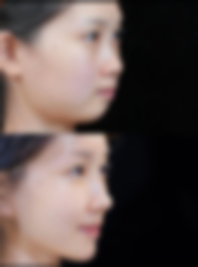 割包皮的其他好处