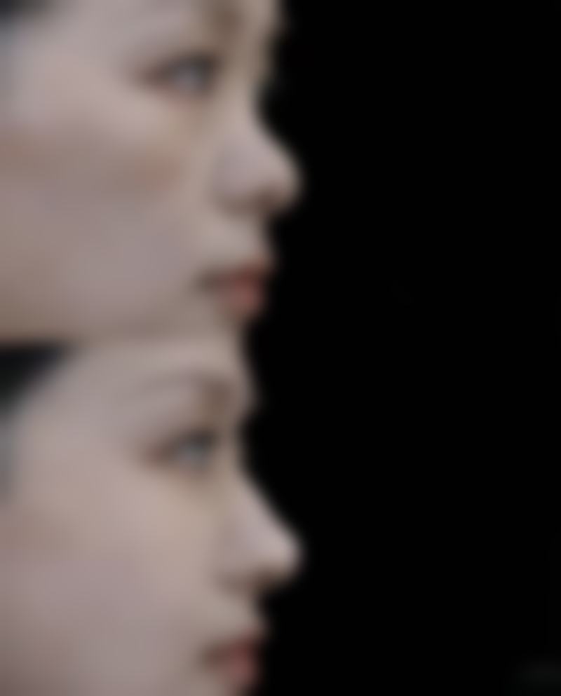 瑞士Teosyal Redensity I肌肤营养饮