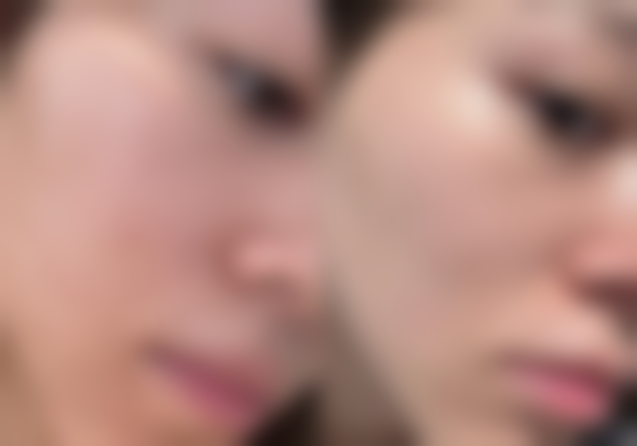 成都艺美医疗美容诊所医院技术好不好?