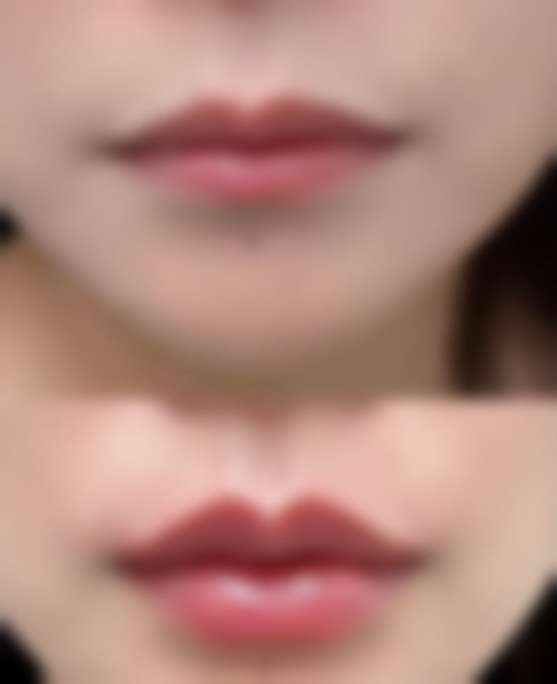 韩国365mc医院李在濬(兰斯特别中 心院长)医生挂号预约攻略