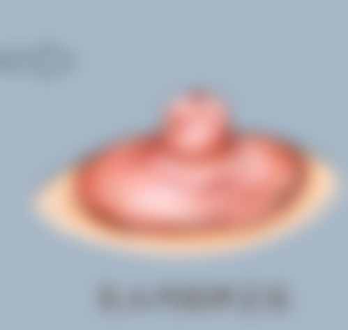 选择合适的医院和医生