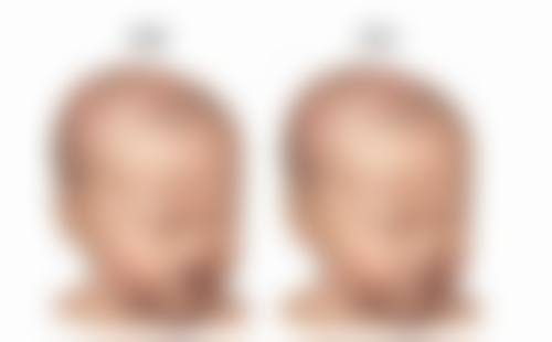 广州伯明翰医疗整形美容医院收费标准参考