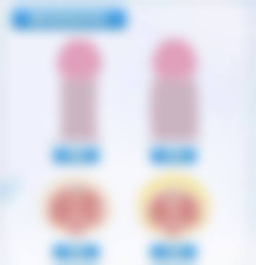 影响手术成效的其他因素