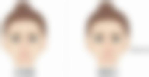 做双眼皮手术要多久才能恢复好？恢复时间受手术方式、体质、护理影响一般1 - 3个月 