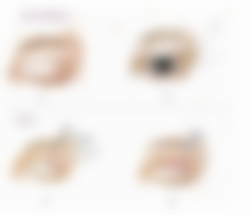 腹部抽脂手术危险吗？有危险但可通过术前术后举措把风险降到最低