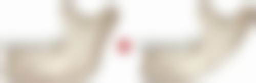 湖州尚丽医疗美容门诊部收费标准参考