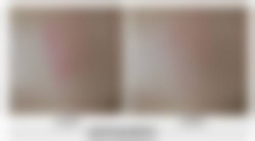 湖州尚丽医疗美容门诊部医院技术好不好?