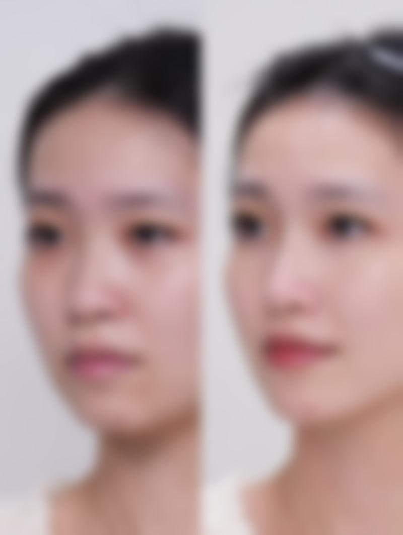 北京四惠中医医院整形科收费标准参考