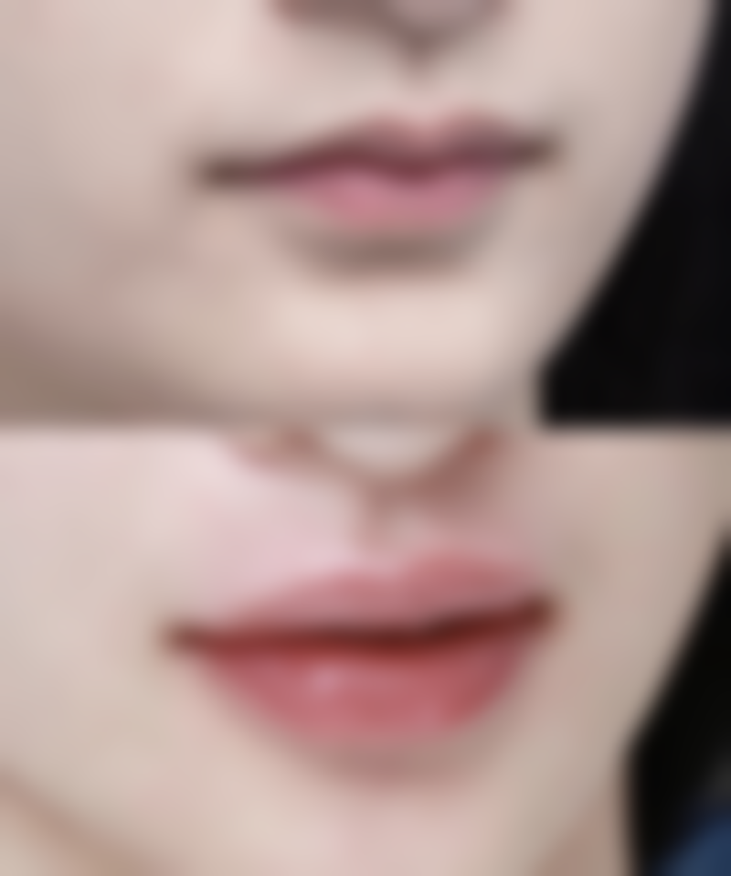 韩国365mc医院姜敏翰（大邱院）医生技术好不好？