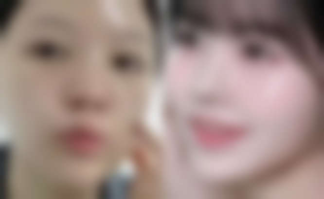 深圳呈悦医疗美容门诊部庄家荣医生挂号预约攻略