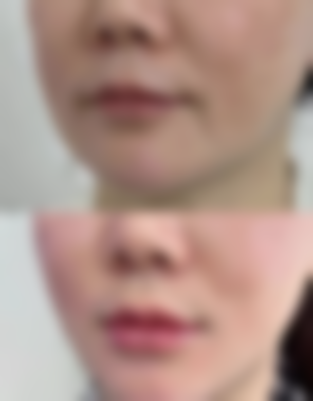 湖州尚丽医疗美容门诊部口碑如何?