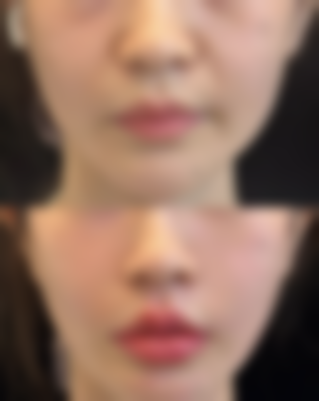 成都九州华昀惠芝美韵整形医院医院技术好不好?