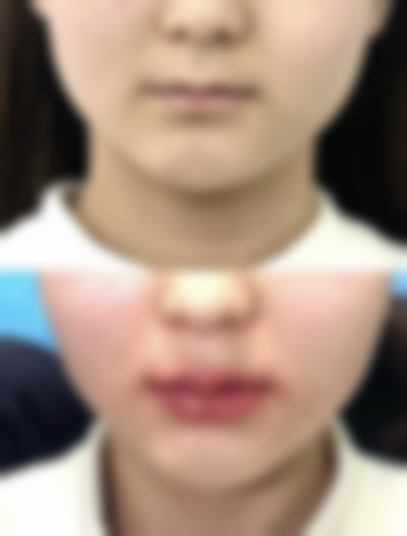 总结——宿迁同仁皮肤病医院怎么样?