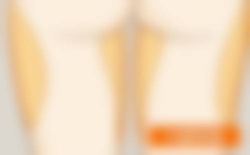 常德华美整形美容诊所李佳美医生技术好不好？