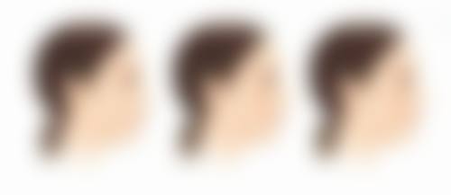 梅州方圆医疗美容诊所收费标准参考